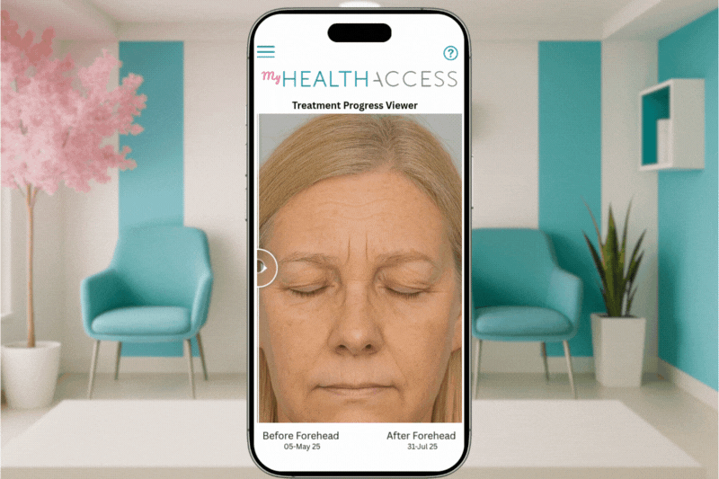 myHealthAccess Treatment Progress Viewer