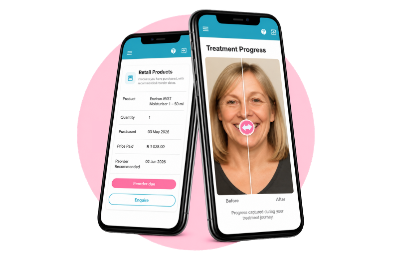 Treatment progress and retail on mobile