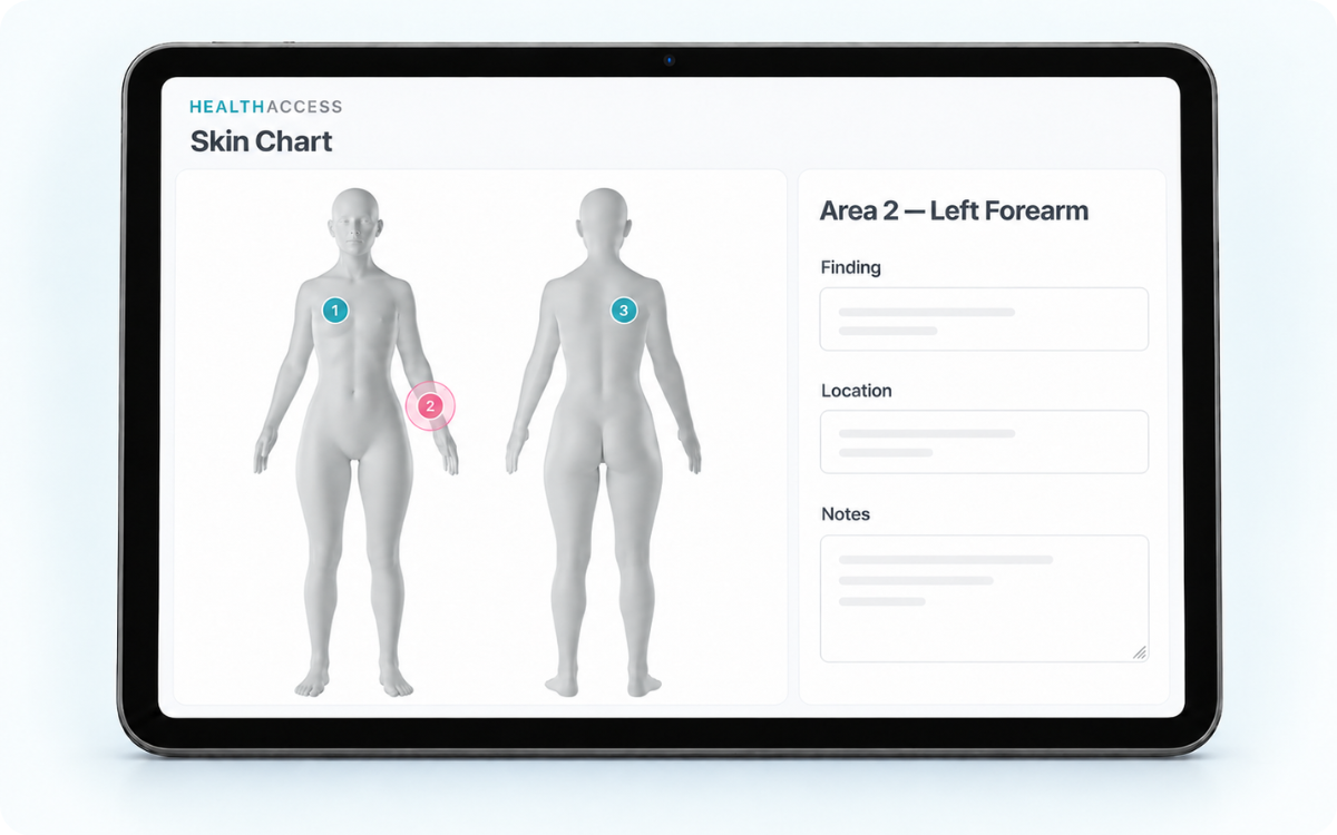 Visual skin chart in HealthAccess with areas of concern marked and annotated